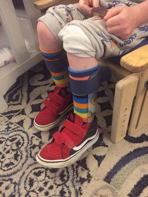 Polly & Andy knee high rainbow bamboo socks with AFO Splints